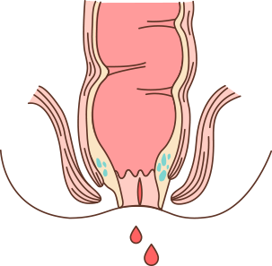 치열 이미지